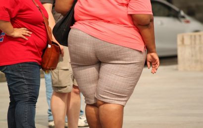 World’s most obese man dies after weight-loss surgery